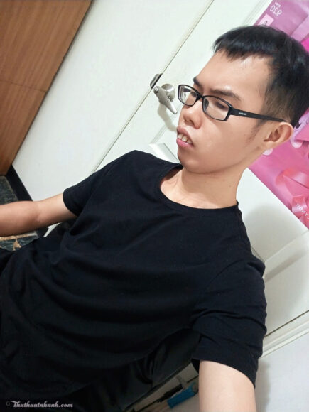 Ảnh trai xấu đeo kính