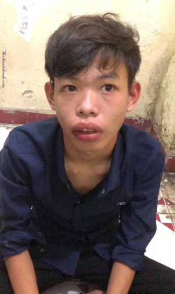 Ảnh trai xấu răng vẩu