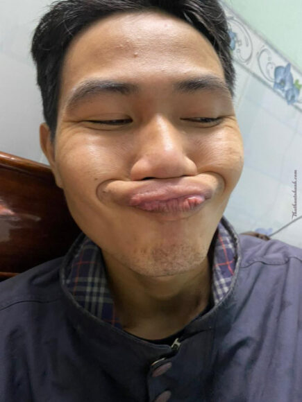 Hình ảnh trai xấu hài