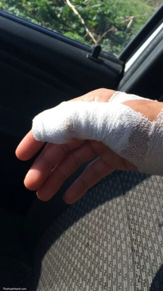 Hình ảnh đứt tay troll bạn bè