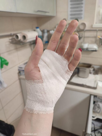 Hình ảnh đứt tay troll người yêu