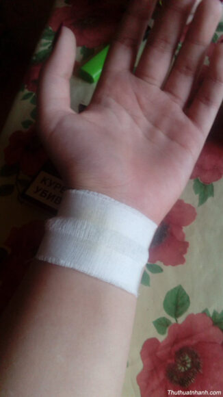 Hình ảnh đứt tay troll nhẹ