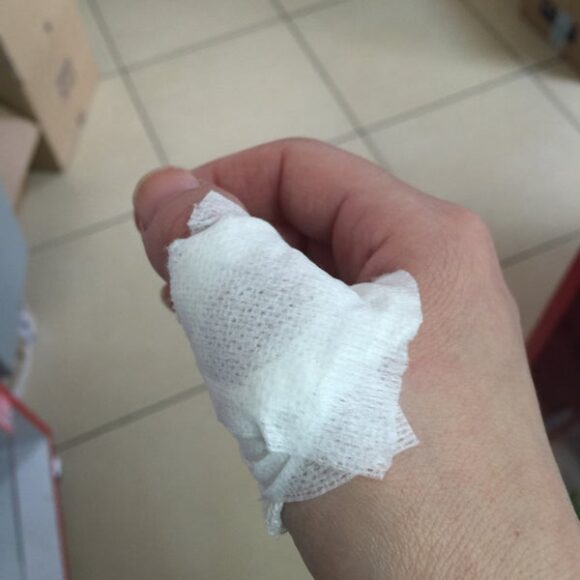 hình đứt tay troll ny