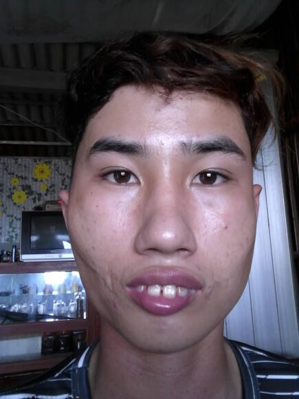 Hình ảnh trai xấu K9