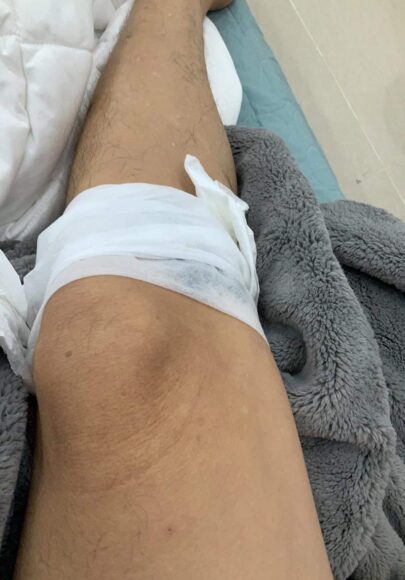 ảnh bị thương đầu gấu