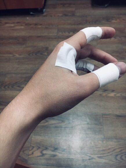 ảnh bị thương ngón tay