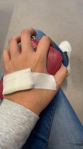 ảnh bị thương nhẹ