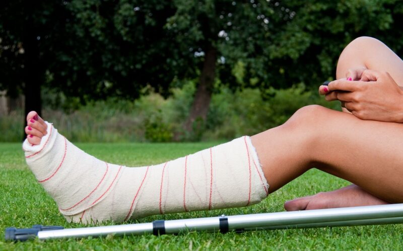 hình ảnh bị ngã gãy chân