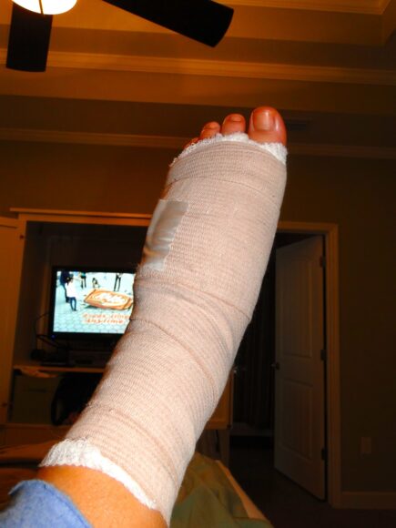 hình ảnh bị thương băng bó chân