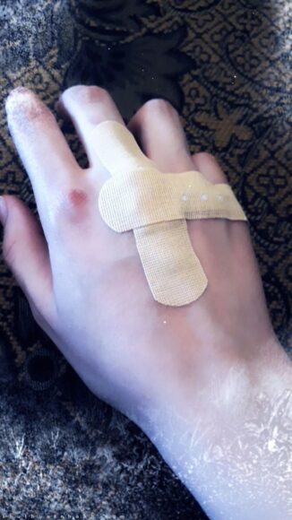 hình ảnh đứt tay troll thử lòng người yêu